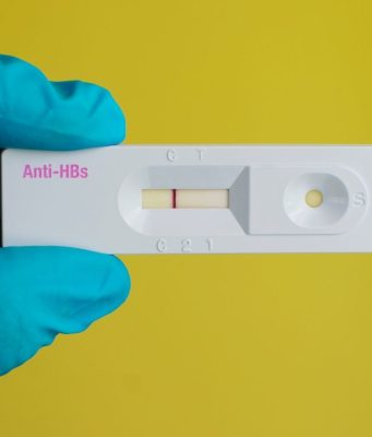 Anti HBs Nedir ve Test Sonuçları Ne Anlama Gelir