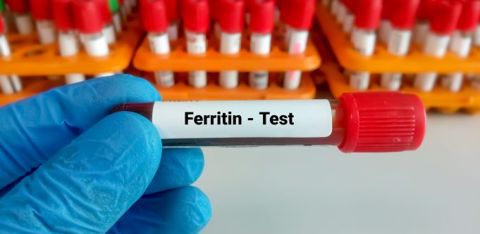 ferritin-kac-olmali