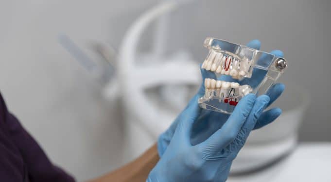 dosya-1769121025-dis-implanti