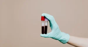 Eldivenli el laboratuvarda anti HBs testi için alınmış kan tüplerini tutuyor
