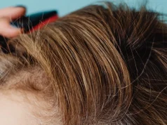 Seboreik Dermatit Neden Olur ve Yağlı Pullanma Nasıl Kontrol Altına Alınır Saç derisinde seboreik dermatit kontrolü için saçlarını ayıran kadın