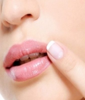 Uçuk Neden Olur Nasıl Geçer?